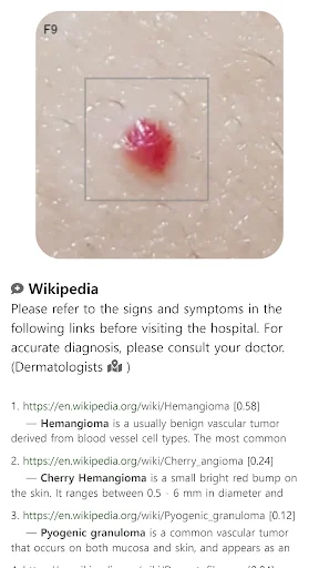 Model Dermatol डाउनलोड करें – स्किन डिजीज चेक और इमेज एटलस - Screenshot 11